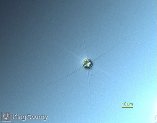 Photo of Apedinella spinifera